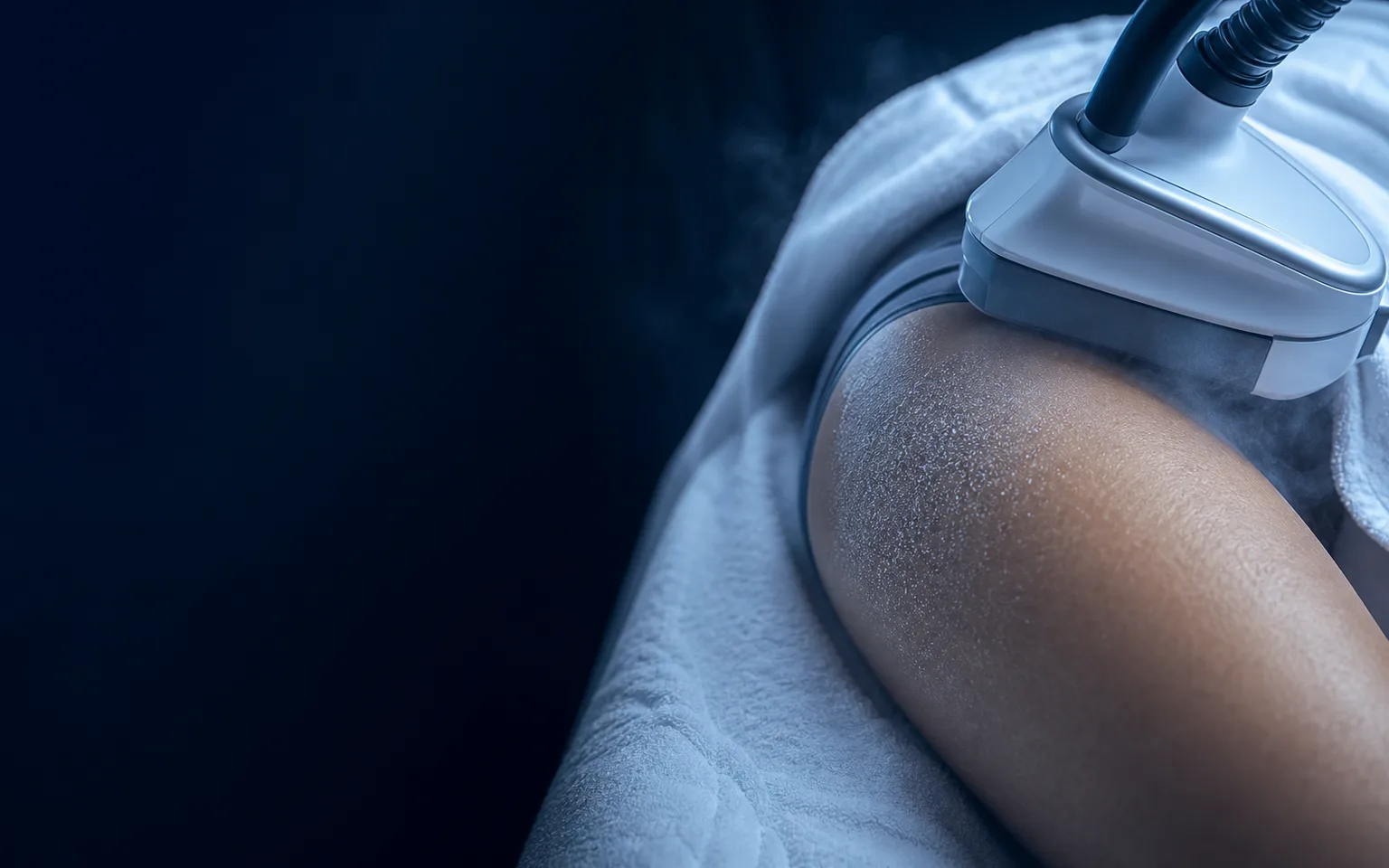 Applicateur de cryolipolyse posé sur une zone de cuisse en cabinet médical